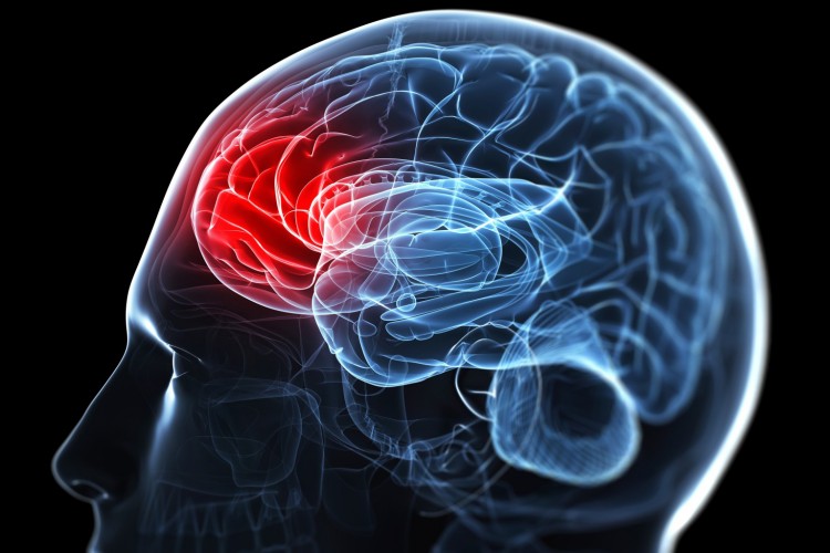 Κινητική αποκατάσταση σε Αγγειακό Εγκεφαλικό Επεισόδιο: Ο ρόλος της Φυσικοθεραπείας